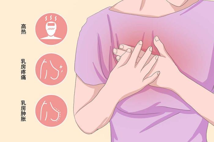 乳腺 炎 症狀​