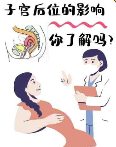 子宮後傾懷孕