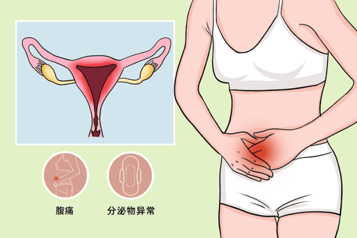 子宮 發炎 原因