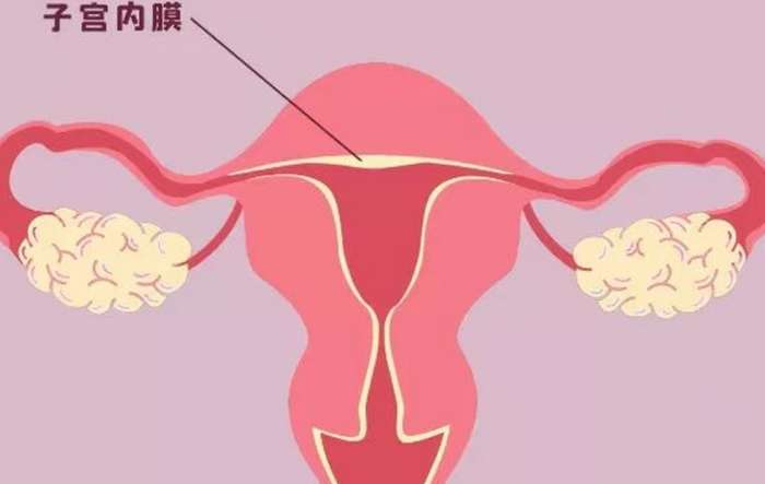 子宮內膜增生原因